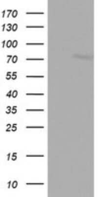 Western Blot: FBXO11 Antibody (OTI1F6)Azide and BSA Free [NBP2-72219]