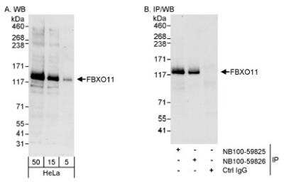 Western Blot: FBXO11 Antibody [NB100-59825]