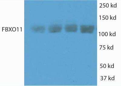 Western Blot: FBXO11 Antibody [NB100-59826]