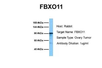 Western Blot: FBXO11 Antibody [NBP1-55066]