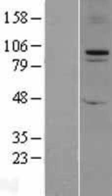 Western Blot: FBXO11 Overexpression Lysate [NBL1-10620]