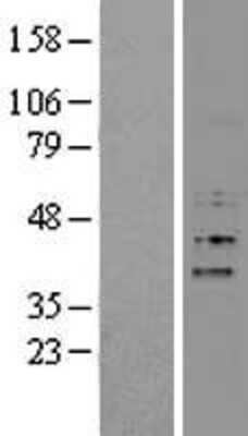 Western Blot: F-box protein 15/FBXO15 Overexpression Lysate [NBP2-05321]