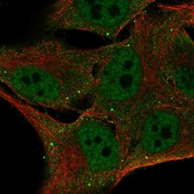 Immunocytochemistry/ Immunofluorescence: FBXO16 Antibody [NBP2-55041]