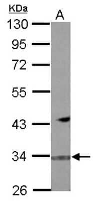 Western Blot: FBXO16 Antibody [NBP2-16445]