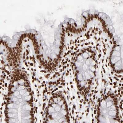 Immunohistochemistry-Paraffin: FBXO18 Antibody [NBP1-83921]