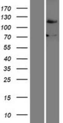 Western Blot: FBXO18 Overexpression Lysate [NBP2-05970]