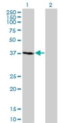 Western Blot: FBXO2 Antibody (1G4) [H00026232-M01]