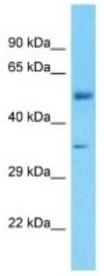 Western Blot: FBXO2 Antibody [NBP3-10565]