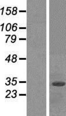 Western Blot: FBXO2 Overexpression Lysate [NBP2-07485]