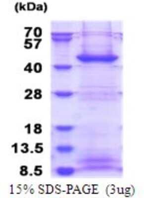 SDS-PAGE: Recombinant Human FBXO2 His Protein [NBP2-51764]