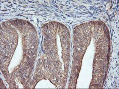 Immunohistochemistry-Paraffin: FBXO21 Antibody (OTI2C7) [NBP2-01569]