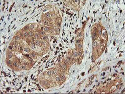 Immunohistochemistry-Paraffin: FBXO21 Antibody (OTI2C7) [NBP2-01569]