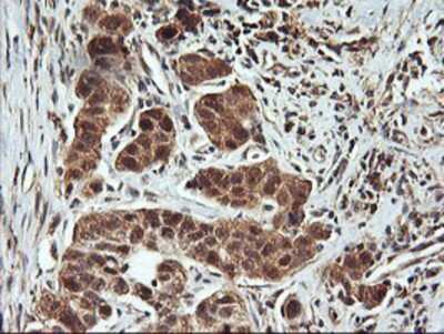 Immunohistochemistry-Paraffin: FBXO21 Antibody (OTI2C7) [NBP2-01569]