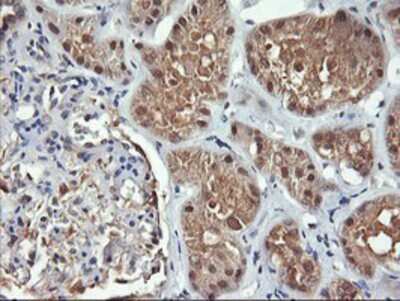 Immunohistochemistry-Paraffin: FBXO21 Antibody (OTI2C7) [NBP2-01569]