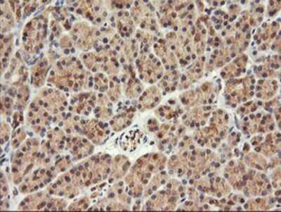 Immunohistochemistry-Paraffin: FBXO21 Antibody (OTI2C7) [NBP2-01569]