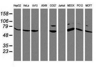 Western Blot: FBXO21 Antibody (OTI2C7) [NBP2-01569]