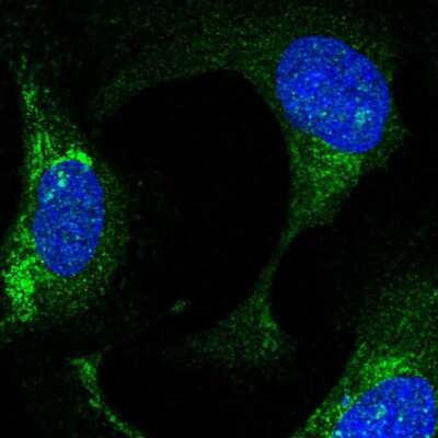 Immunocytochemistry/ Immunofluorescence: FBXO21 Antibody [NBP2-55942]