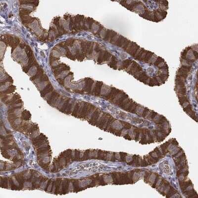 Immunohistochemistry-Paraffin: FBXO21 Antibody [NBP2-57452]