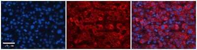 Immunohistochemistry-Paraffin: FBXO21 Antibody [NBP3-10566]