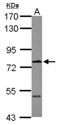 Western Blot: FBXO21 Antibody [NBP2-16446]