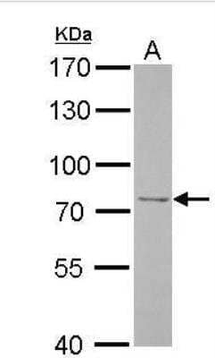 Western Blot: FBXO21 Antibody [NBP2-16446]