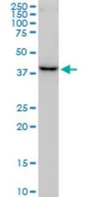 Western Blot: FBXO22 Antibody (6G9) [H00026263-M01]