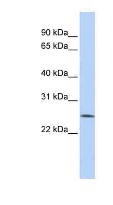 Western Blot: FBXO22 Antibody [NBP1-55425]