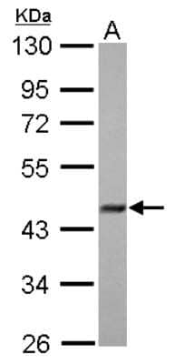 Western Blot: FBXO22 Antibody [NBP2-16447]