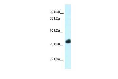 Western Blot: FBXO22 Antibody [NBP2-88818]