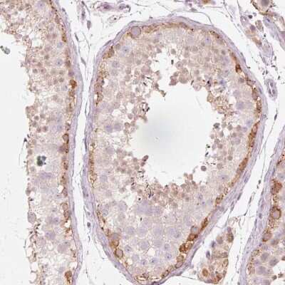 Immunohistochemistry: FBXO24 Antibody [NBP2-47457]