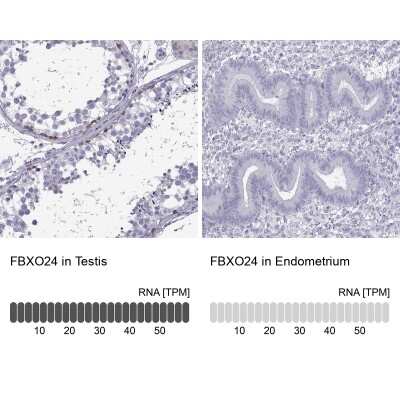 Immunohistochemistry-Paraffin: FBXO24 Antibody [NBP2-47457]