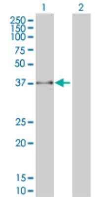 Western Blot: FBXO25 Antibody (2F1) [H00026260-M01]