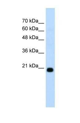 Western Blot: FBXO25 Antibody [NBP1-55045]