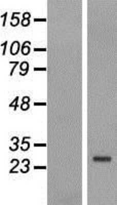 Western Blot: FBXO25 Overexpression Lysate [NBP2-07486]