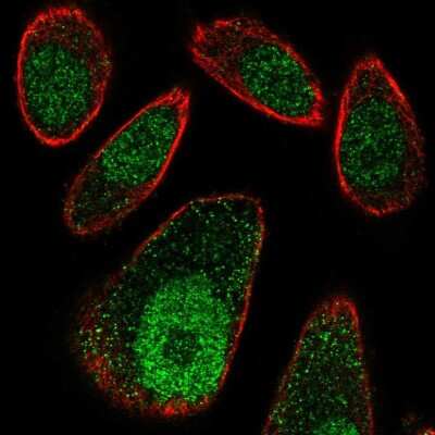 Immunocytochemistry/ Immunofluorescence: FBXO27 Antibody [NBP2-56468]