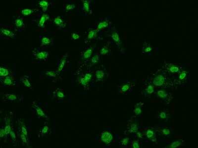 Immunocytochemistry/ Immunofluorescence: FBXO27 Antibody [NBP2-98144]