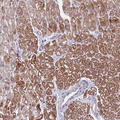 Immunohistochemistry-Paraffin: FBXO27 Antibody [NBP2-32048]