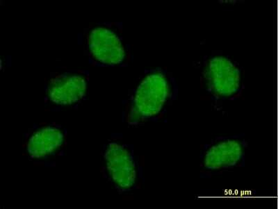 Immunocytochemistry/ Immunofluorescence: FBXO28 Antibody [H00023219-B01P]