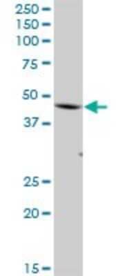 Western Blot: FBXO28 Antibody [H00023219-B01P]