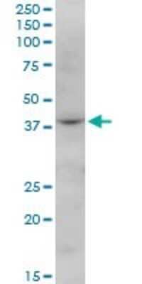 Western Blot: FBXO28 Antibody [H00023219-B01P]