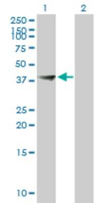 Western Blot: FBXO28 Antibody [H00023219-B01P]