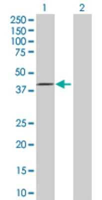 Western Blot: FBXO28 Antibody [H00023219-D01P]