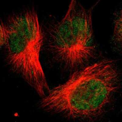 Immunocytochemistry/ Immunofluorescence: FBXO3 Antibody [NBP2-55679]