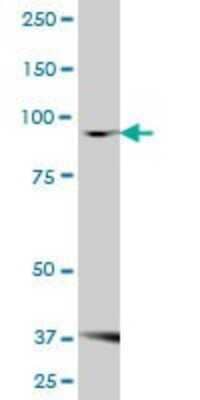 Western Blot: FBXO30 Antibody [H00084085-B01P]