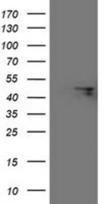 Western Blot: FBXO31 Antibody (OTI1H1) [NBP2-01508]