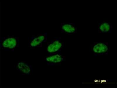 Immunocytochemistry/ Immunofluorescence: FBXO31 Antibody [H00079791-B01P]