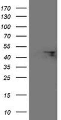 Western Blot: FBXO31 Antibody (OTI1H1)Azide and BSA Free [NBP2-72208]