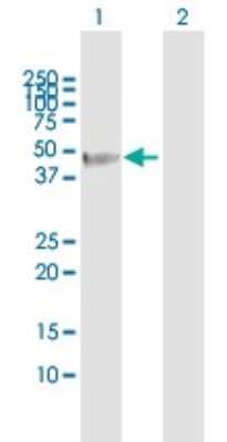 Western Blot: FBXO31 Antibody [H00079791-B01P]