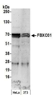 Western Blot: FBXO31 Antibody [NBP1-19088]