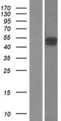 Western Blot: FBXO31 Overexpression Lysate [NBL1-10631]